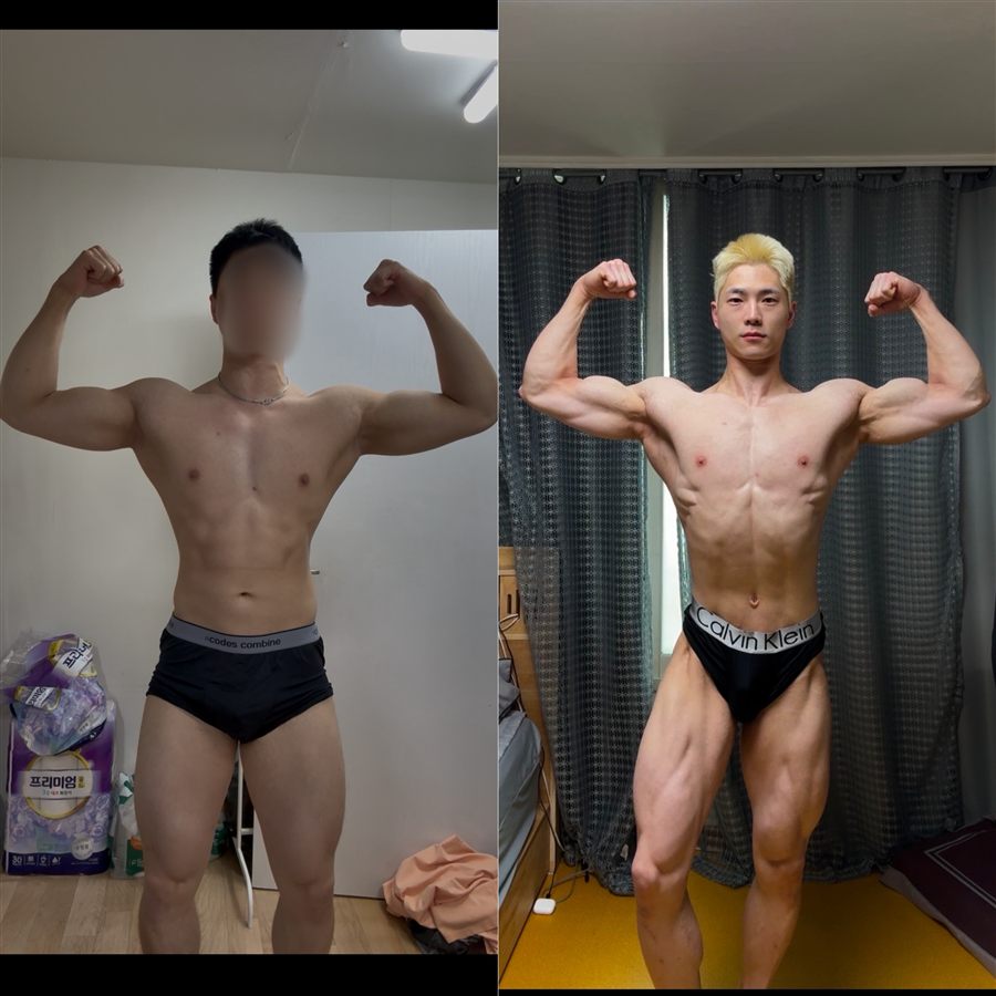 체지방감량 바디라인 비포애프터